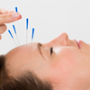 Acupuncture for treatment of Migranes